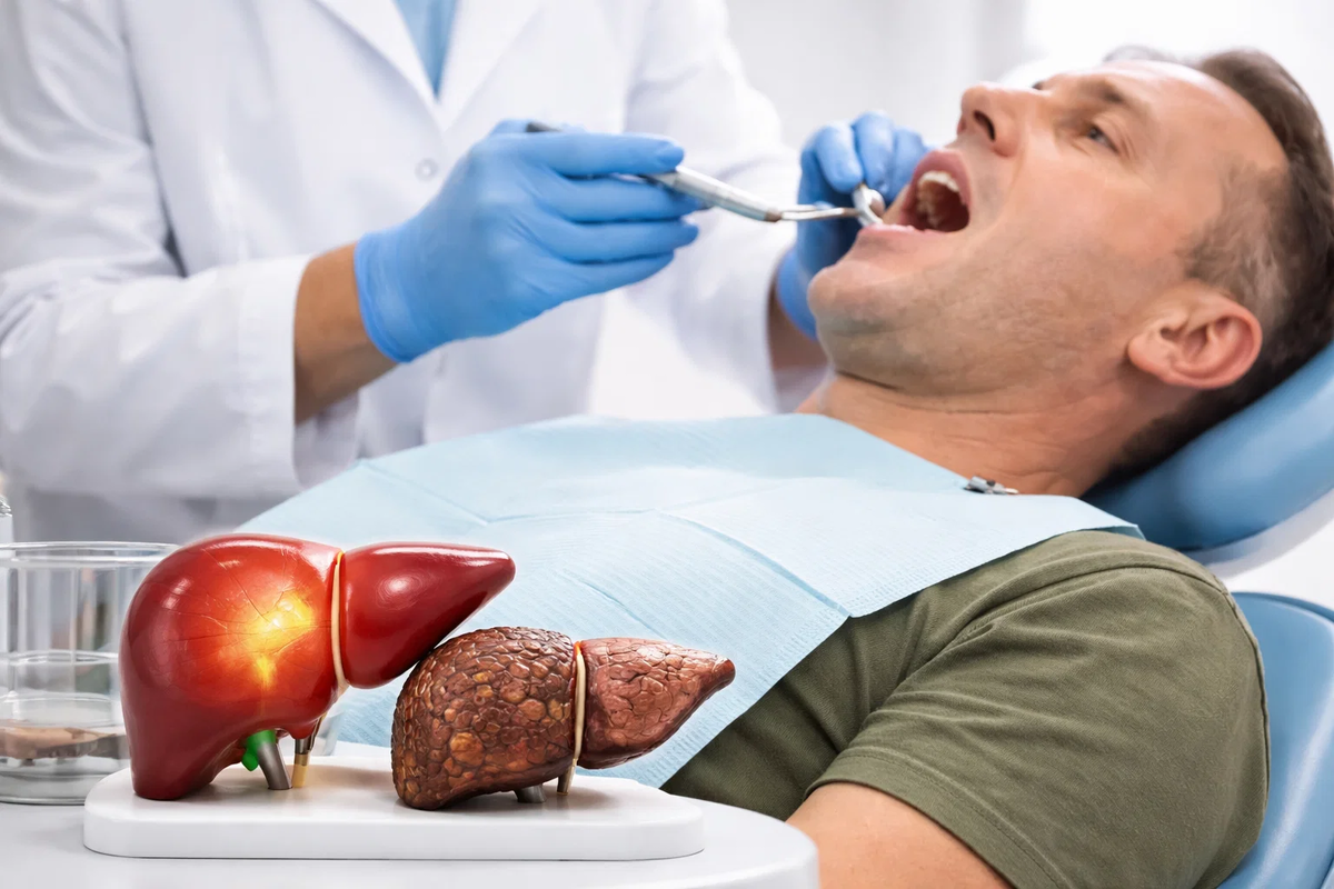 Как простая гигиена полости рта может снизить риск рака печени
